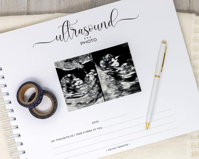 Personalized Twin Pregnancy Journal (8 Center Designs) - Hardcover Pregnancy Memory Book Customized with Babies’ Name, Nickname or Phrase - Prompted Journal for New Moms (Gray Hearts + Gray) - Image 6