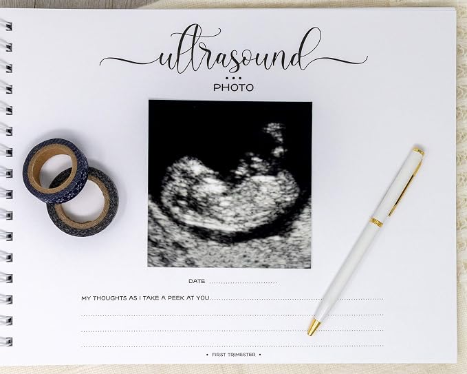 Personalized Pregnancy Journal (15 Center Designs) - Hardcover Pregnancy Memory Book Customized with Baby’s Name, Nickname or Phrase - Prompted Journal for New Moms - Image 6