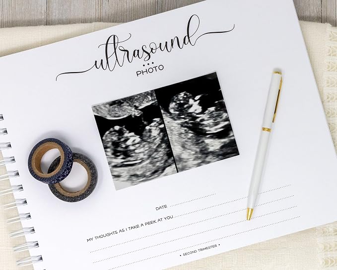 Personalized Twin Pregnancy Journal (8 Center Designs) - Hardcover Pregnancy Memory Book Customized with Babies’ Names, Nicknames or Phrase - Prompted Journal for New Moms (Ivory Dots) - Image 6